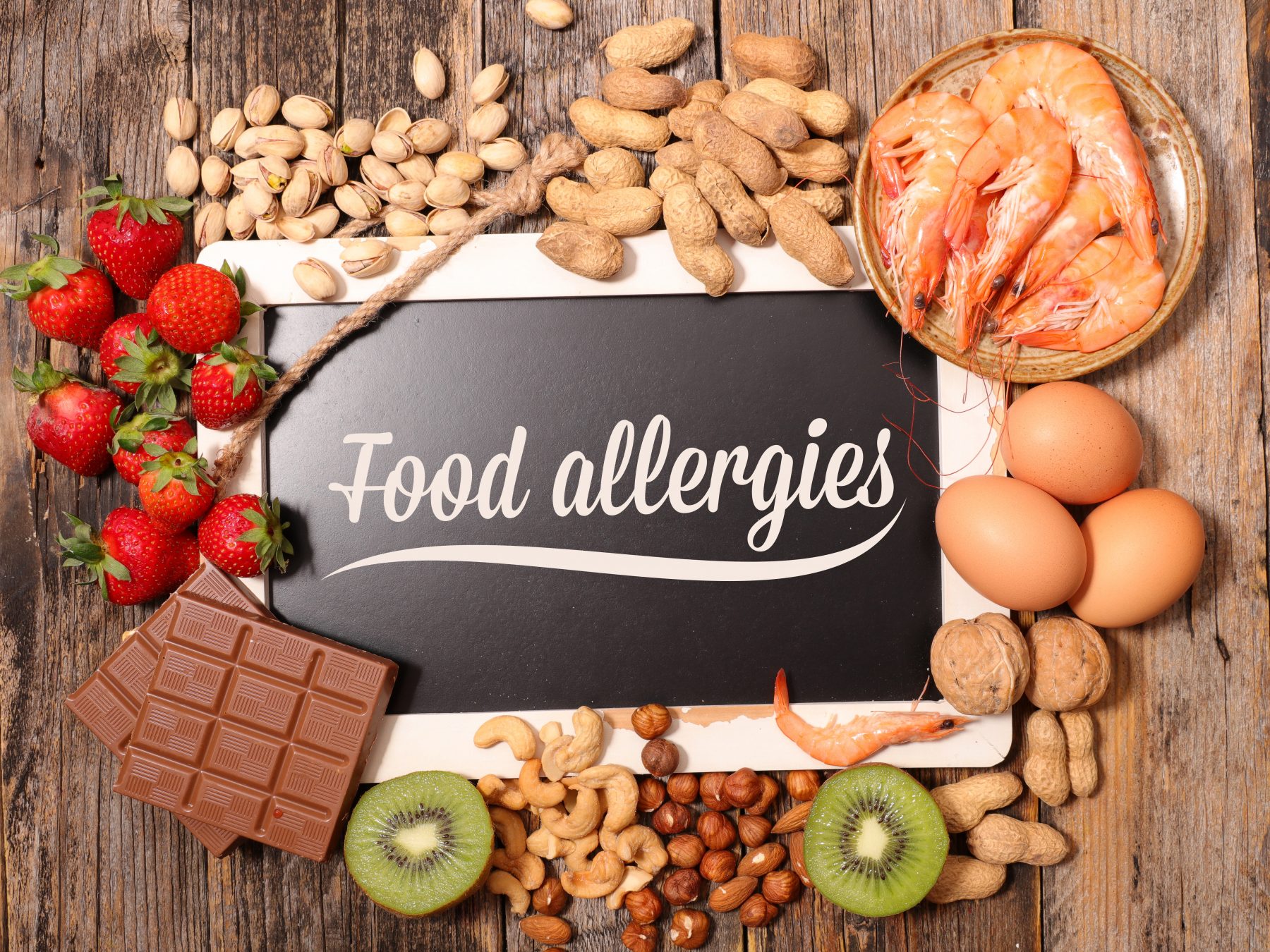 Food allergy sample of foods