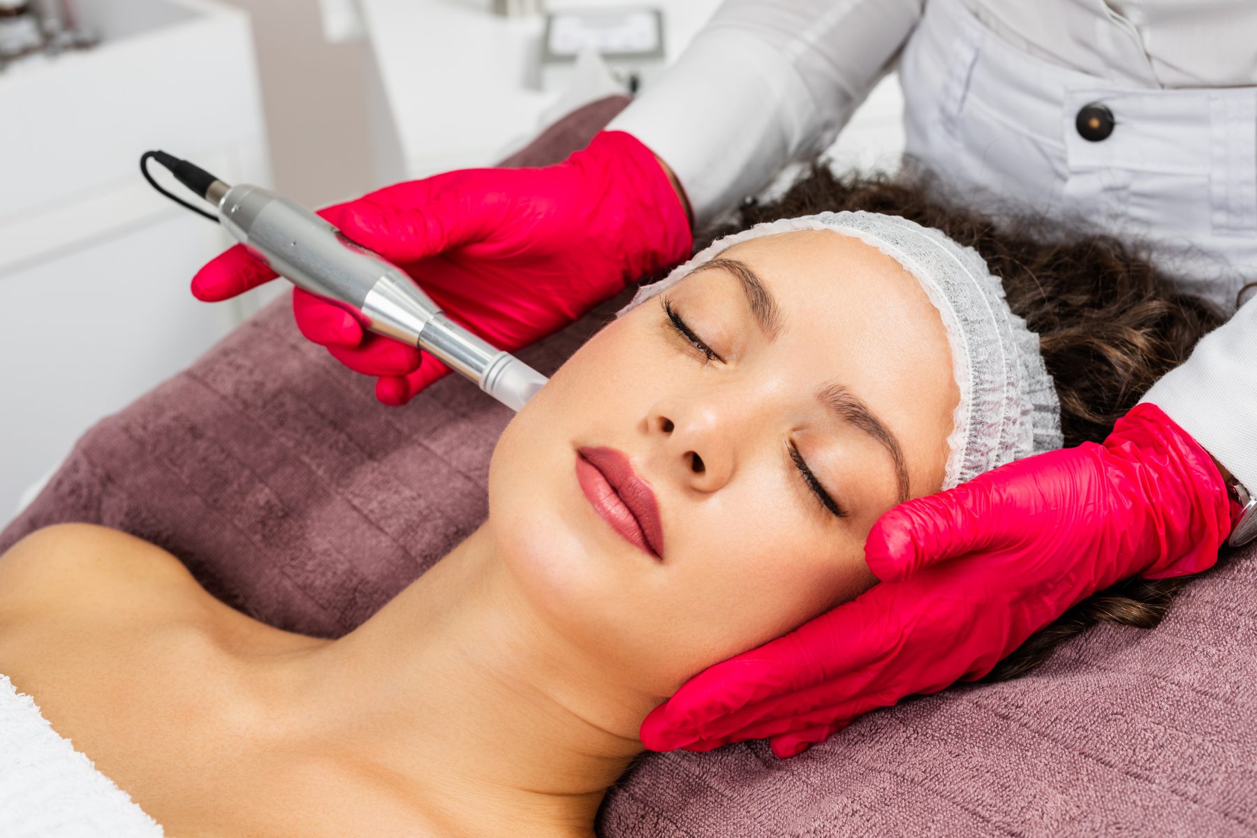 Woman receiving microneedling rejuvenation treatment also known as a vampire facial