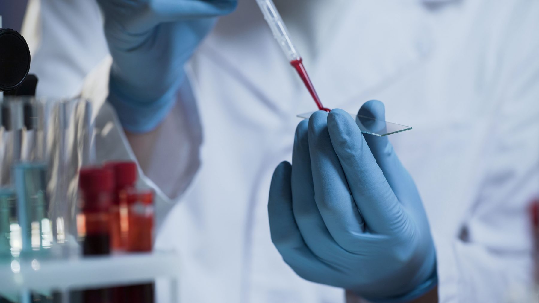 Laboratory worker preparing slide with blood samples