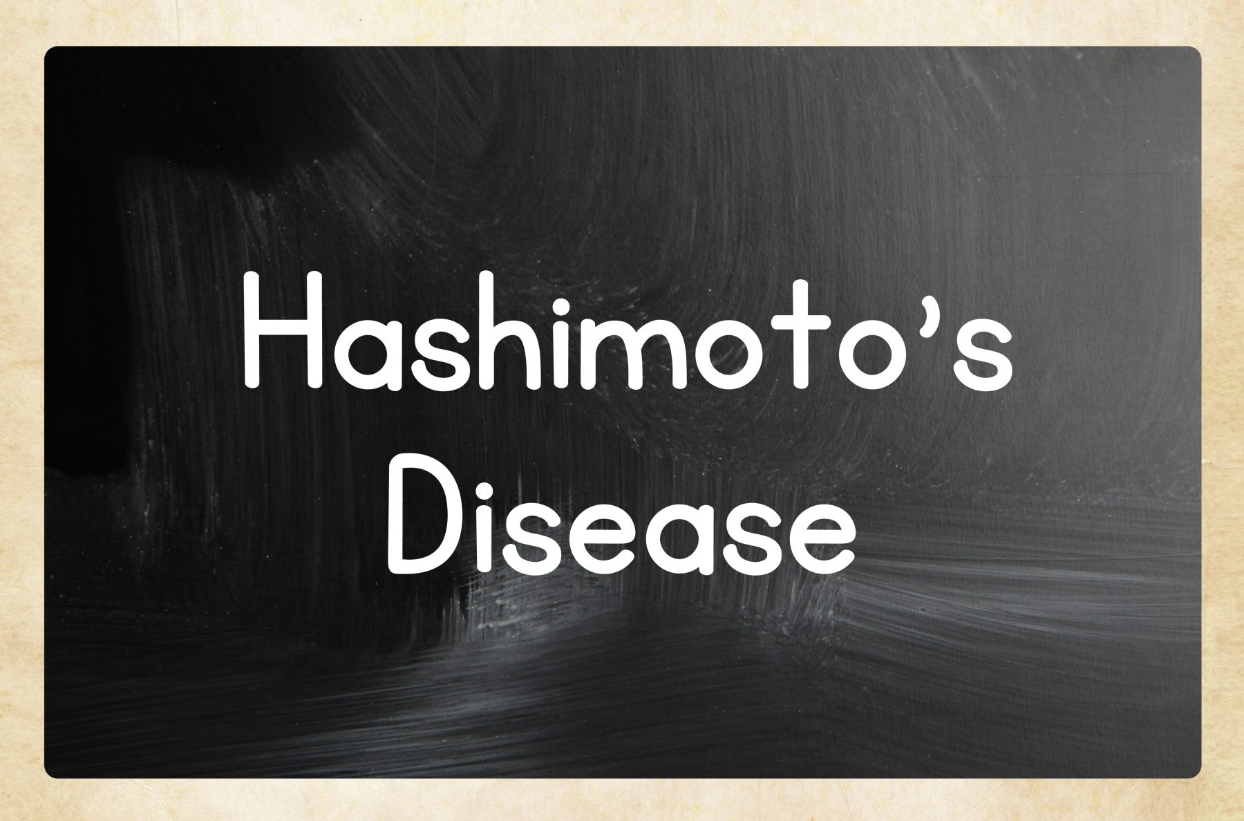 EP 20: Hashimoto’s and the Root Cause of Hypothyroidism