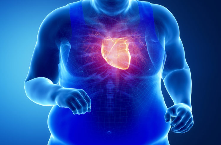 Illustration of an obese man's heart working hard