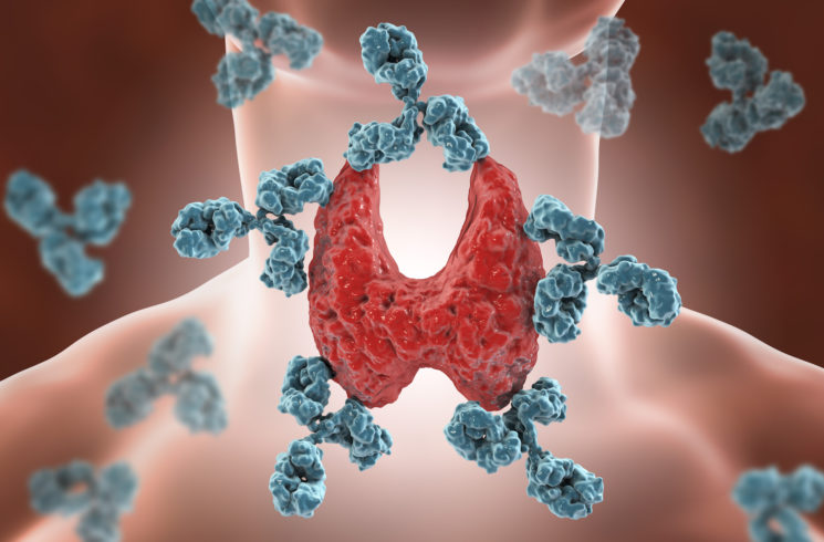 Hashimoto's disease representation with antibodies attacking the thyroid