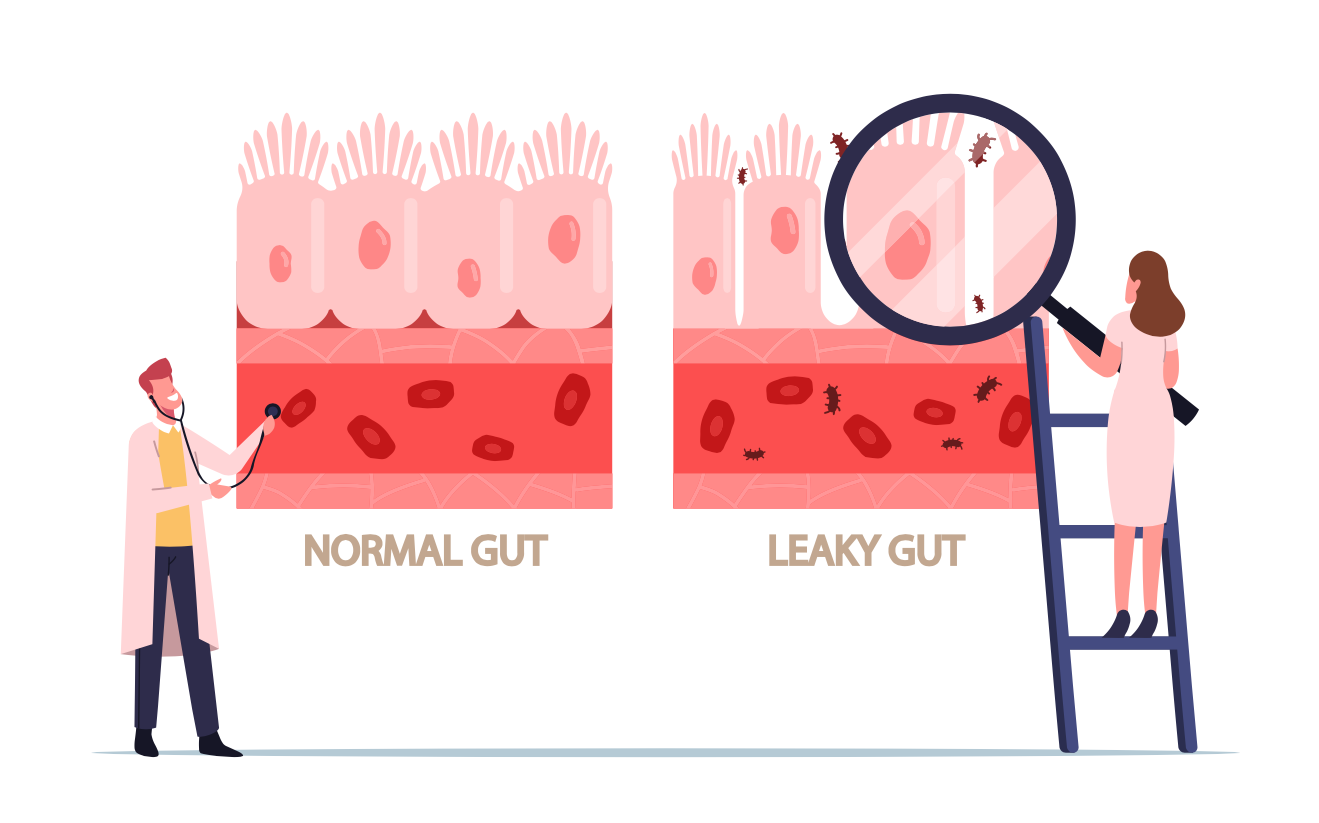 Illustration demonstrating leaky gut