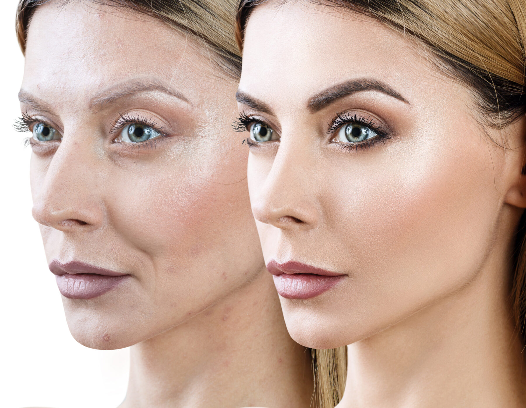 Woman Anti-aging before and after rejuvenation with NAD and NMN