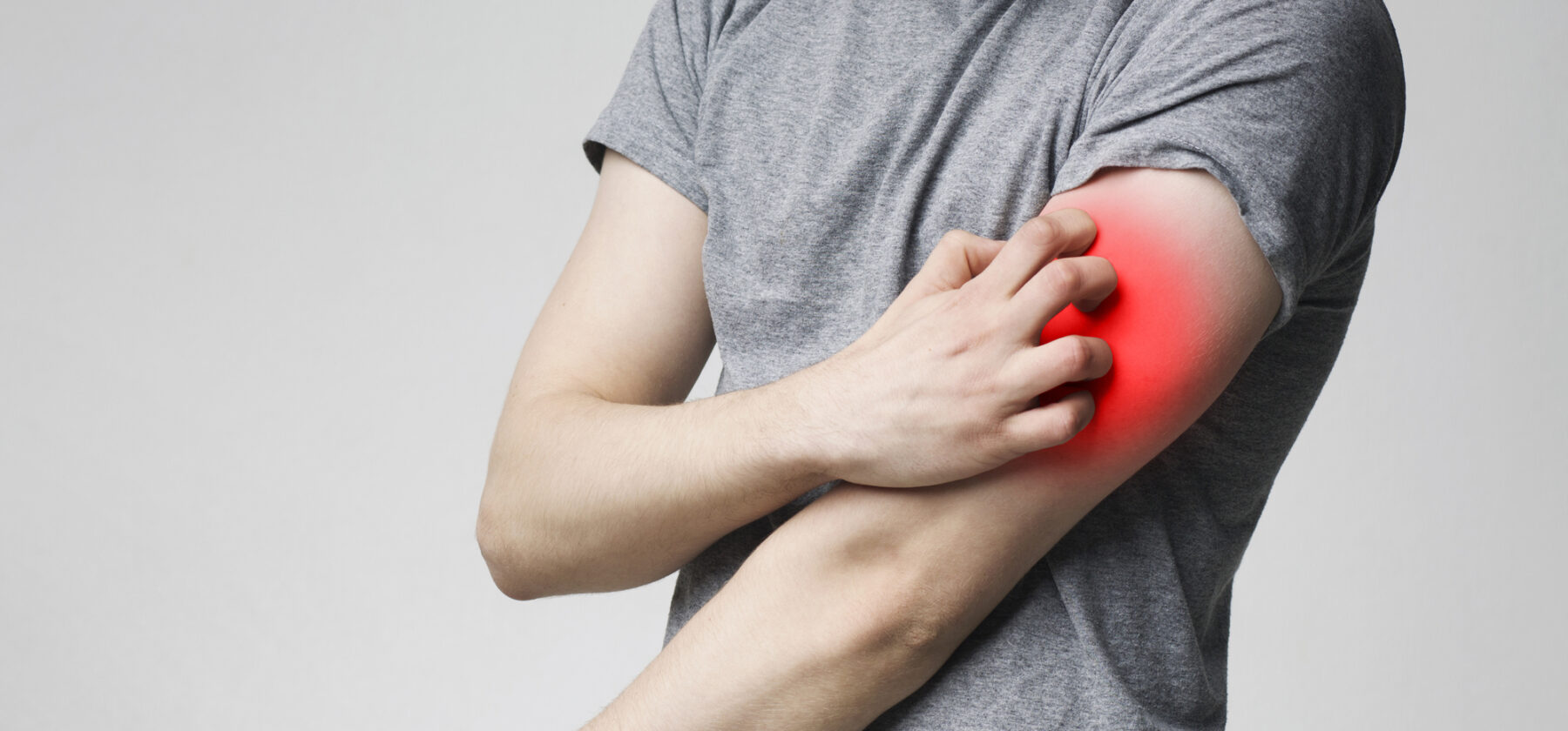 Man scratching red spot on his arm