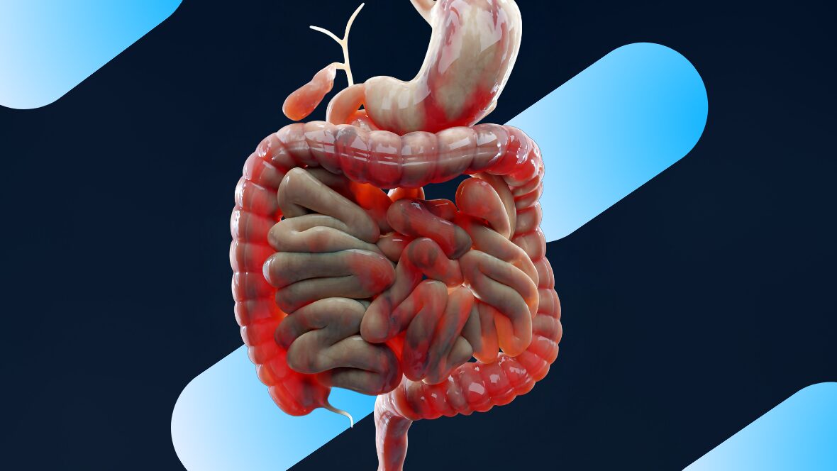 Gut Dysbiosis vs. SIBO: What’s the Difference and Why It Matters